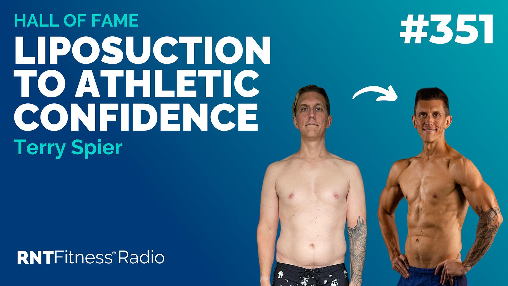 Ep 351 - Hall Of Fame | Terry Spier: Liposuction To Athletic Confidence